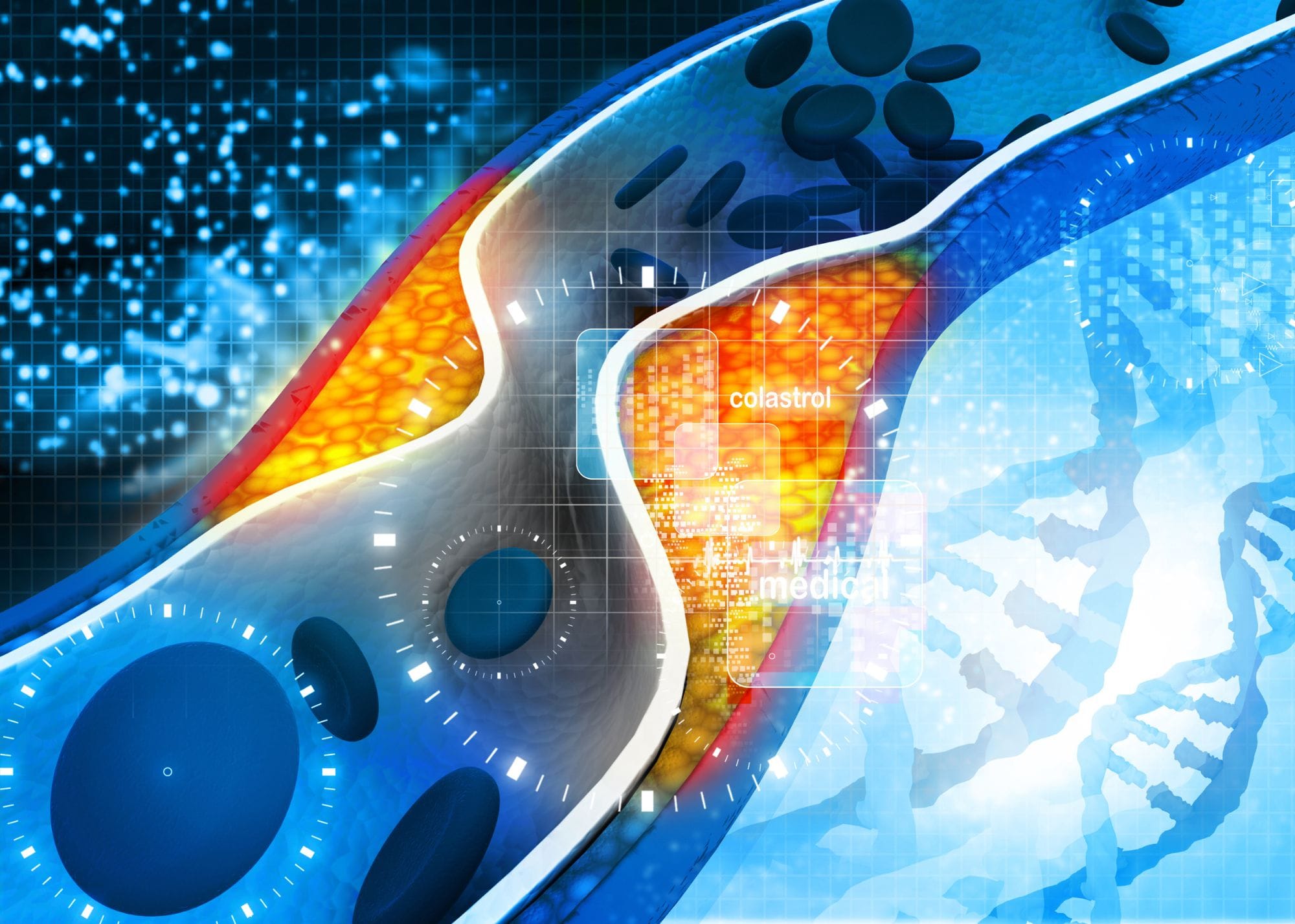 Cholesterol Rewritten: Verve’s Base Editing Therapy May Disrupt a $20B Market